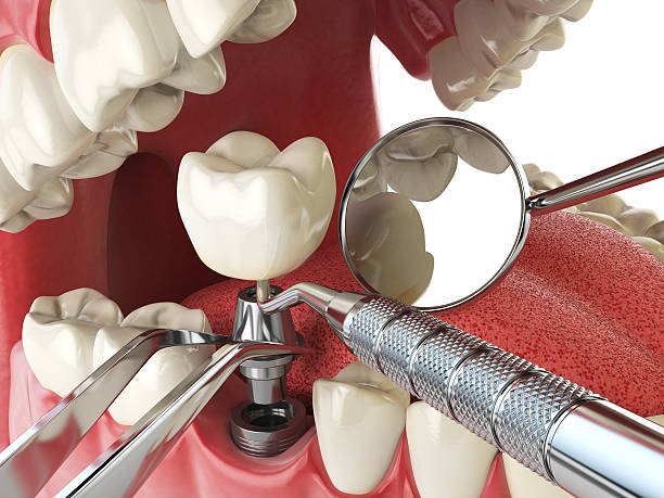 Best Weekend Emergency Dentist in Moxee, WA