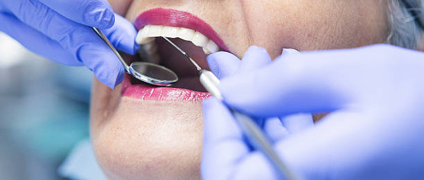 Best Emergency Wisdom Teeth Removal in Moxee, WA